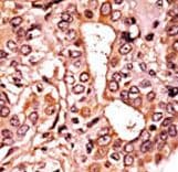 CDK7 Antibody (phospho-Thr170)