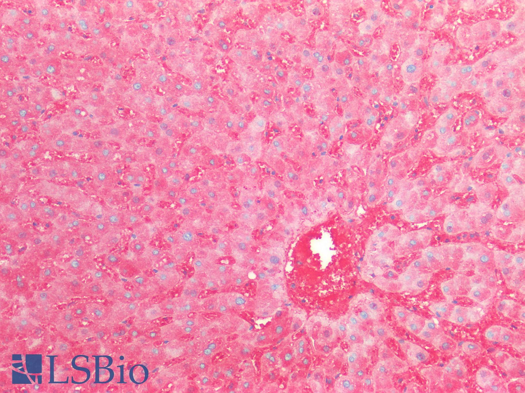 IHC-plus™ Monoclonal Mouse Anti-Human IgA Secondary Antibody (clone NI 69 (A89-034) and NI 184 (A89-035), IHC, IF)