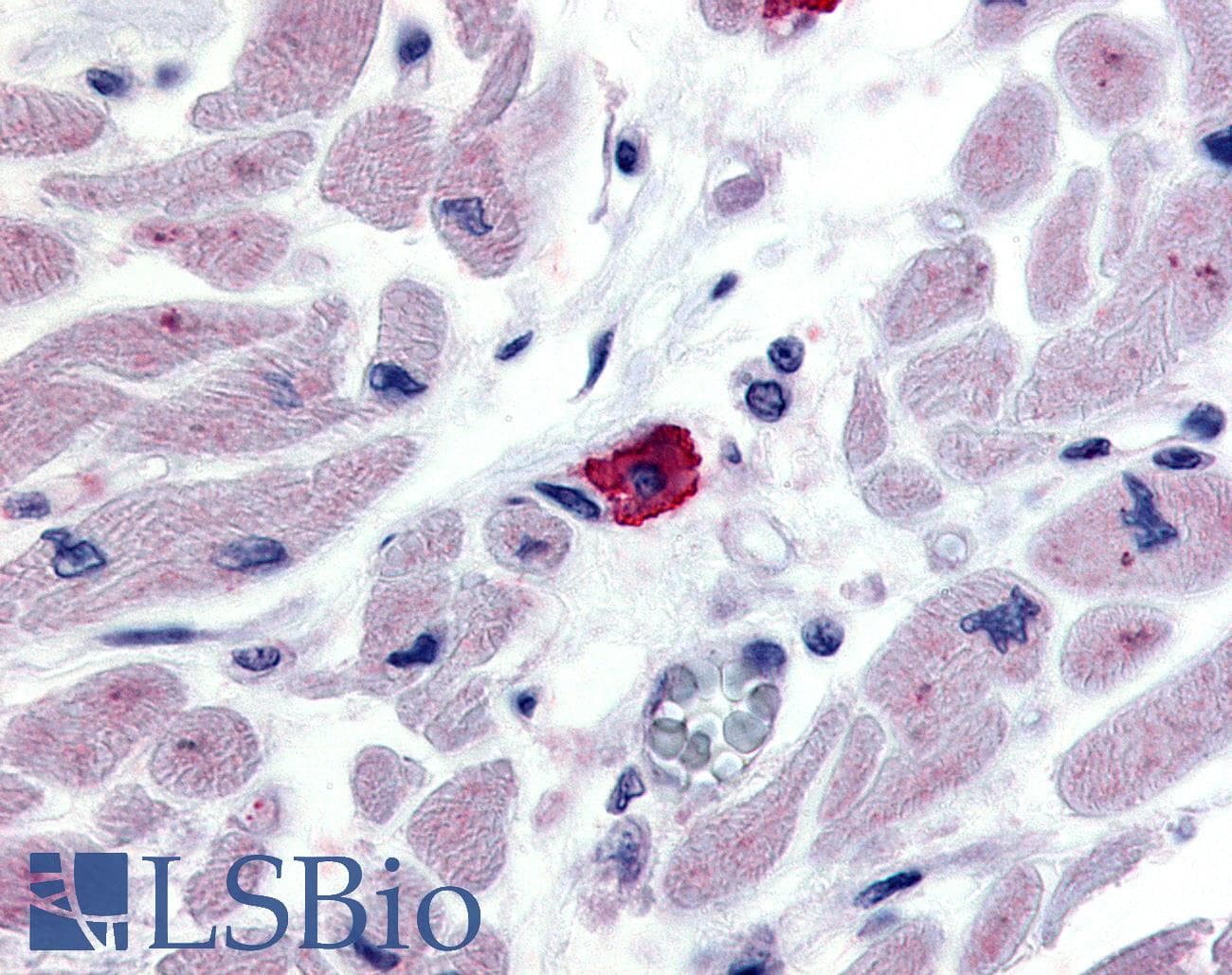 IHC-plus™ ADGRE3 / EMR3 Antibody (N-Terminus)