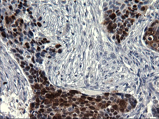 Monoclonal Mouse anti-Human SMAD1 Antibody (clone OTI1C5, IHC, WB)