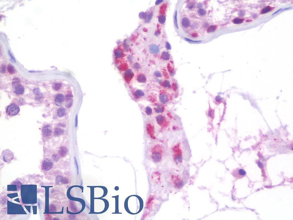 IHC-plus™ Polyclonal Rabbit anti-Human AMHR2 / MISRII Antibody (aa207-440, IHC, WB)