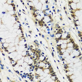 CCDC59 Antibody