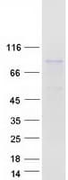 Human CBFA2T3 Protein (Recombinant Myc-DDK (Flag))
