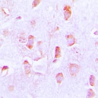 Polyclonal Rabbit anti-Human BCL2 / Bcl-2 Antibody (Internal, IHC, WB)