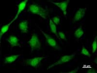 ACIN1 / Acinus Antibody (clone 2005C3a)