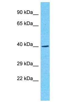 Polyclonal Rabbit anti-Human PTPN20 Antibody (aa20-69, WB)