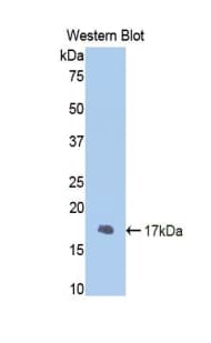 FGB / Fibrinogen Beta Chain Antibody (aa29-118)
