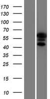 Human KRT9 / CK9 / Cytokeratin 9 Protein (Over-Expression Lysate Myc-DDK (Flag))