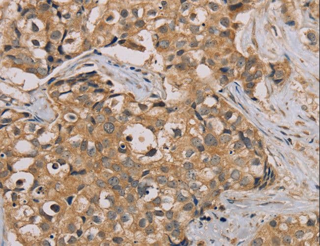 NANOS2 / NOS2 Antibody