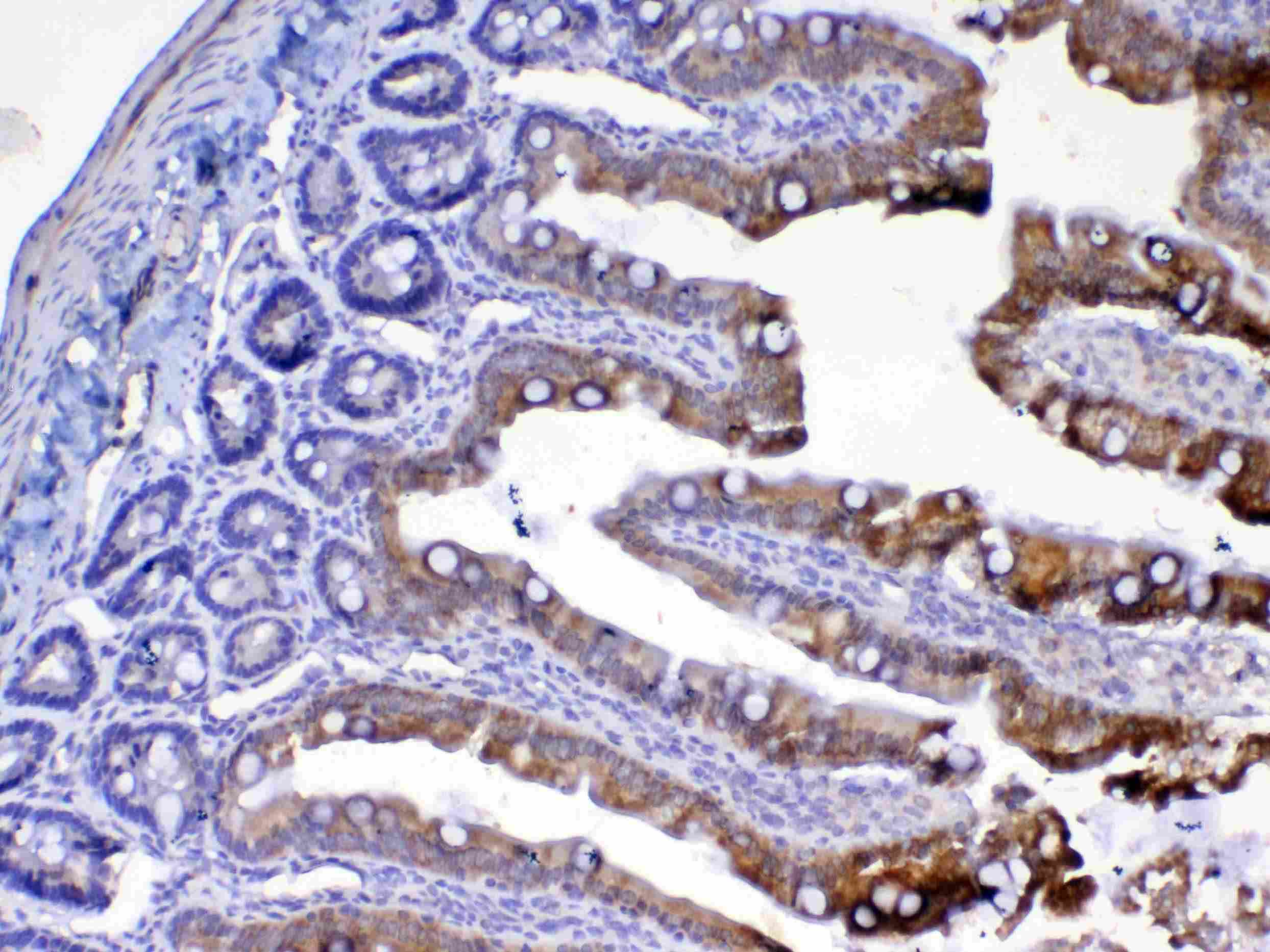 UGT1A / UGT1A1 Antibody