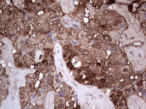 Monoclonal Mouse anti-Human LGALS3 / Galectin 3 Antibody (clone OTI15E4, Carrier-free, IHC, WB)
