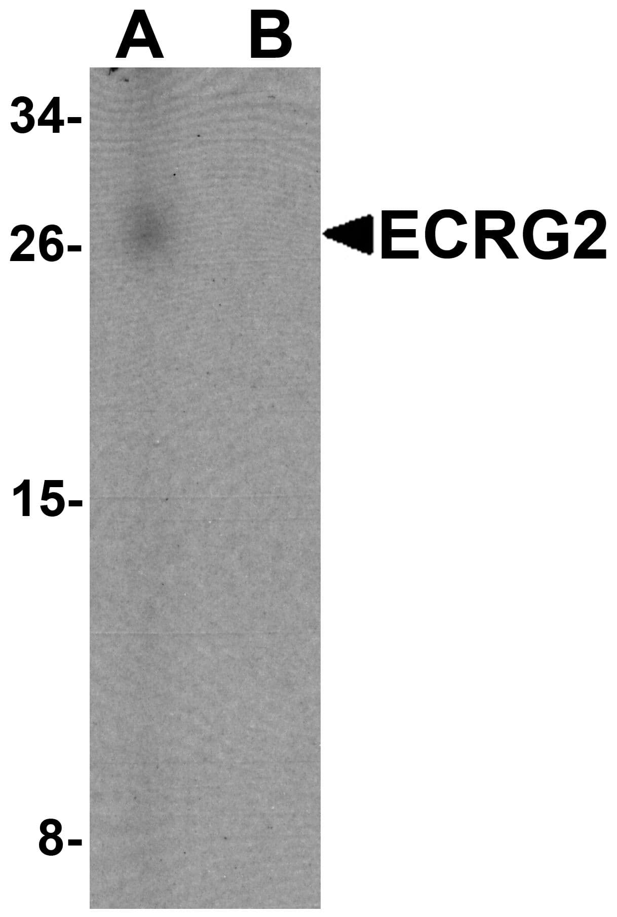IHC-plus™ Polyclonal Chicken anti-Human SPINK7 / ECRG2 Antibody (IHC, WB)