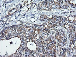 DNM1L / DRP1 Antibody (clone OTI3F4)
