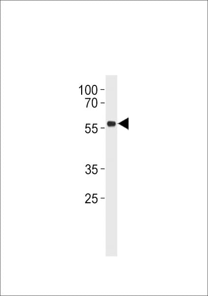IHC-plus™ TP53 / p53 Antibody (Ser315)