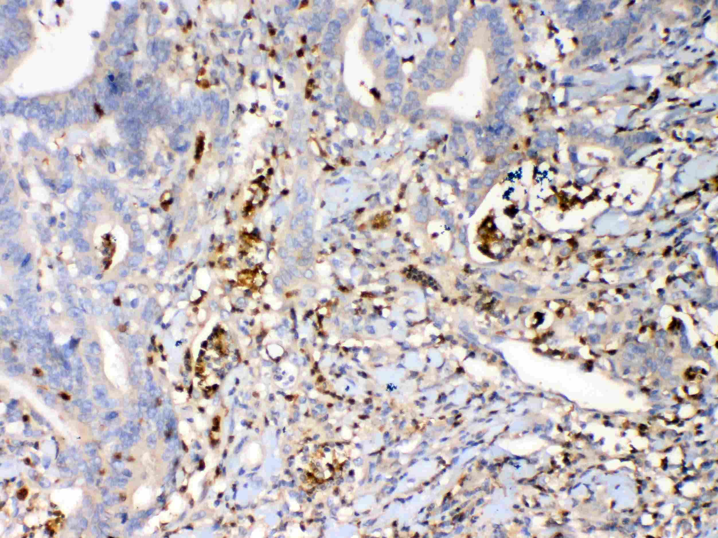 S100A7 / Psoriasin Antibody