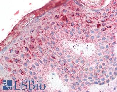 Polyclonal Rabbit anti-Human KLK8 / Kallikrein 8 Antibody (aa29-260, IHC, WB)