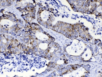 Polyclonal Rabbit anti-Human PIK3CB / PI3K Beta Antibody (IHC, WB)