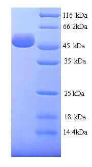 Human HYAL1 Protein (Recombinant His)