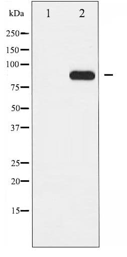 CHUK / IKKA / IKK Alpha Antibody (phospho-Thr23)