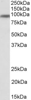 CD71 / Transferrin Receptor Antibody (aa21-35)