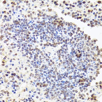 CDX2 Antibody