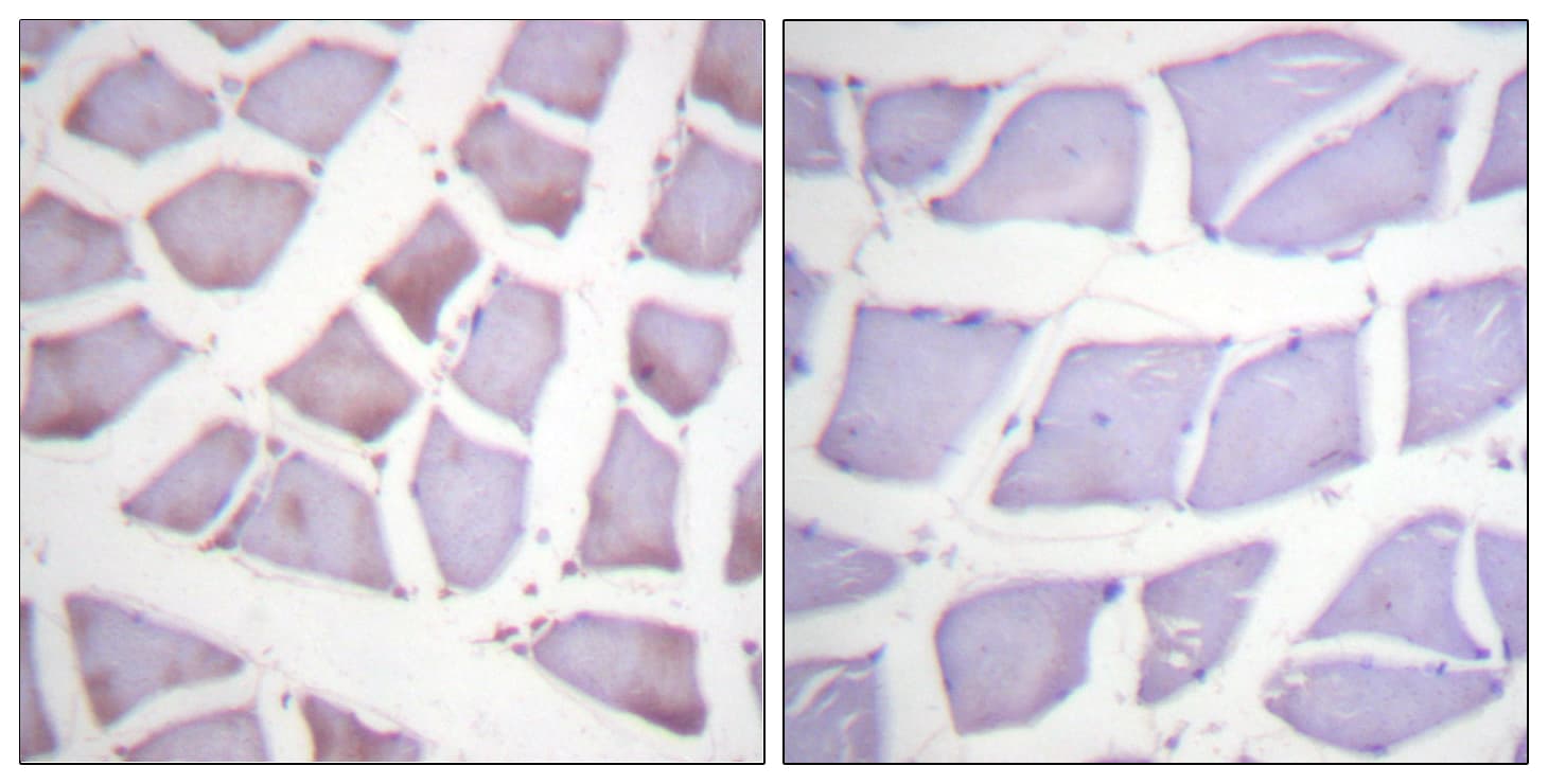 Polyclonal Rabbit anti-Human XIAP Antibody (aa53-102, IHC, WB)