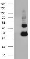 UCK1 Antibody (clone OTI5E9)