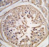 Polyclonal Rabbit anti-Human PUM2 Antibody (aa1-30, IHC, WB)