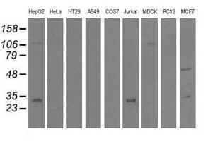 QPRT Antibody (clone OTI1C10, Carrier-free)