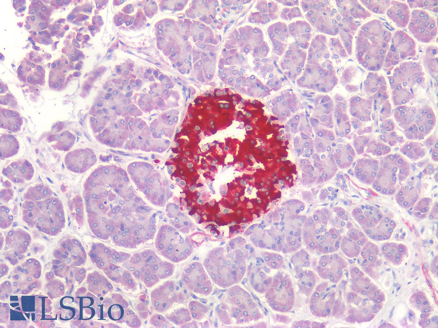 IHC-plus™ Polyclonal Rabbit anti-Human OCLN / Occludin Antibody (IHC)
