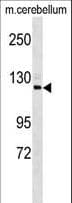 SEMA6D / Semaphorin 6D Antibody (aa19-48)