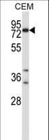 SNK / PLK2 Antibody (aa354-382)