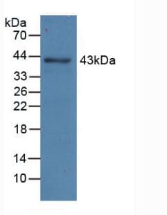 Aspartate Aminotransferase Antibody