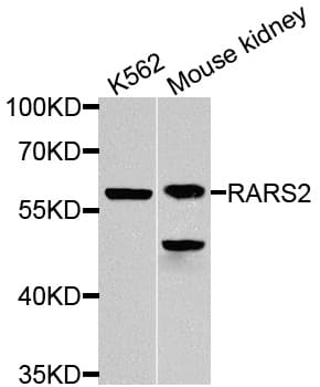 RARS2 / ARGRS Antibody