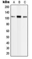 PLD2 / Phospholipase D2 Antibody (phospho-Tyr169)