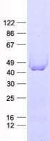 Human SMAP2 Protein (Recombinant His, N-Terminal)