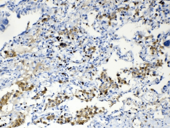 Polyclonal Rabbit anti-Human TMEM107 Antibody (IHC, WB)