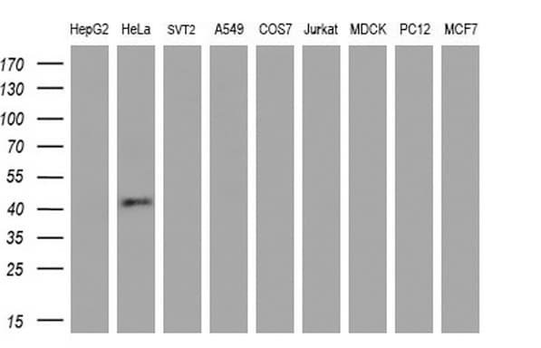 Monoclonal Mouse anti-Human MSTN / GDF8 / Myostatin Antibody (clone OTI7H5, aa24-266, WB)
