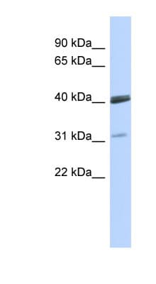 VSX1 Antibody (C-Terminus)