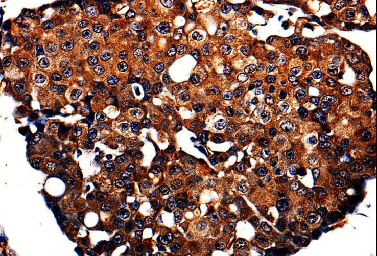 APLP1 / APLP-1 Antibody
