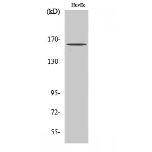 CML / BCR Antibody (120-200 aa)