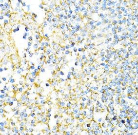 CD8A / CD8 Alpha Antibody