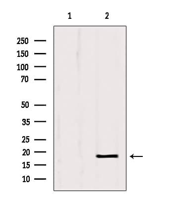 Polyclonal Rabbit anti-Human SRP14 Antibody (IHC, IF, WB)