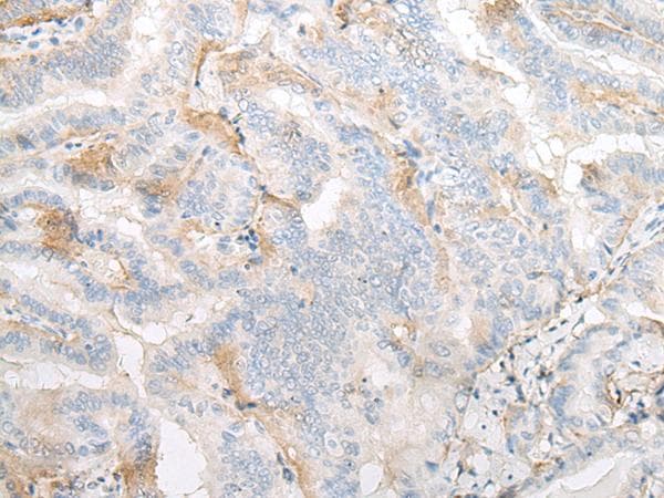 TMEM248 / c7orf42 Antibody