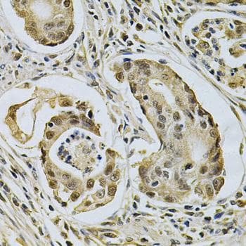 LGALS3 / Galectin 3 Antibody