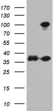 EEF1D Antibody (clone OTI1B9)