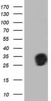 QPRT Antibody (clone OTI4B4)