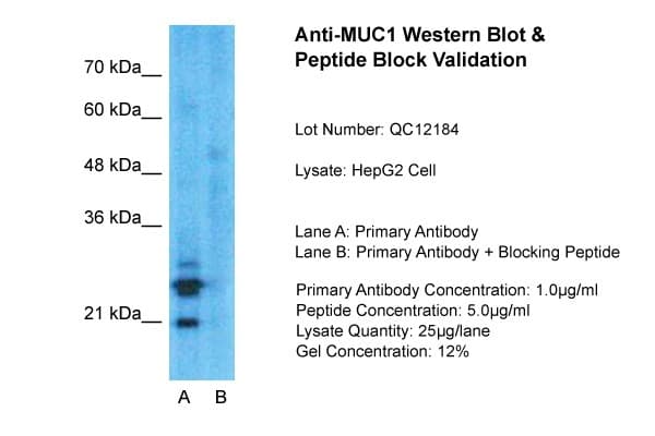 EMA / MUC1 Antibody (aa1192-1241)