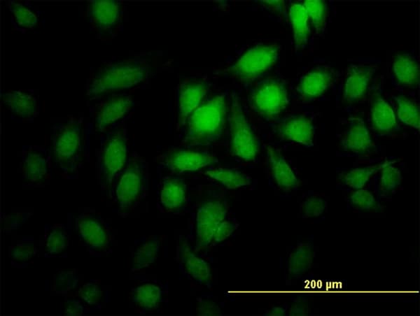 Monoclonal Mouse anti-Human PGGT1B Antibody (clone 5E4, IHC, IF, WB)