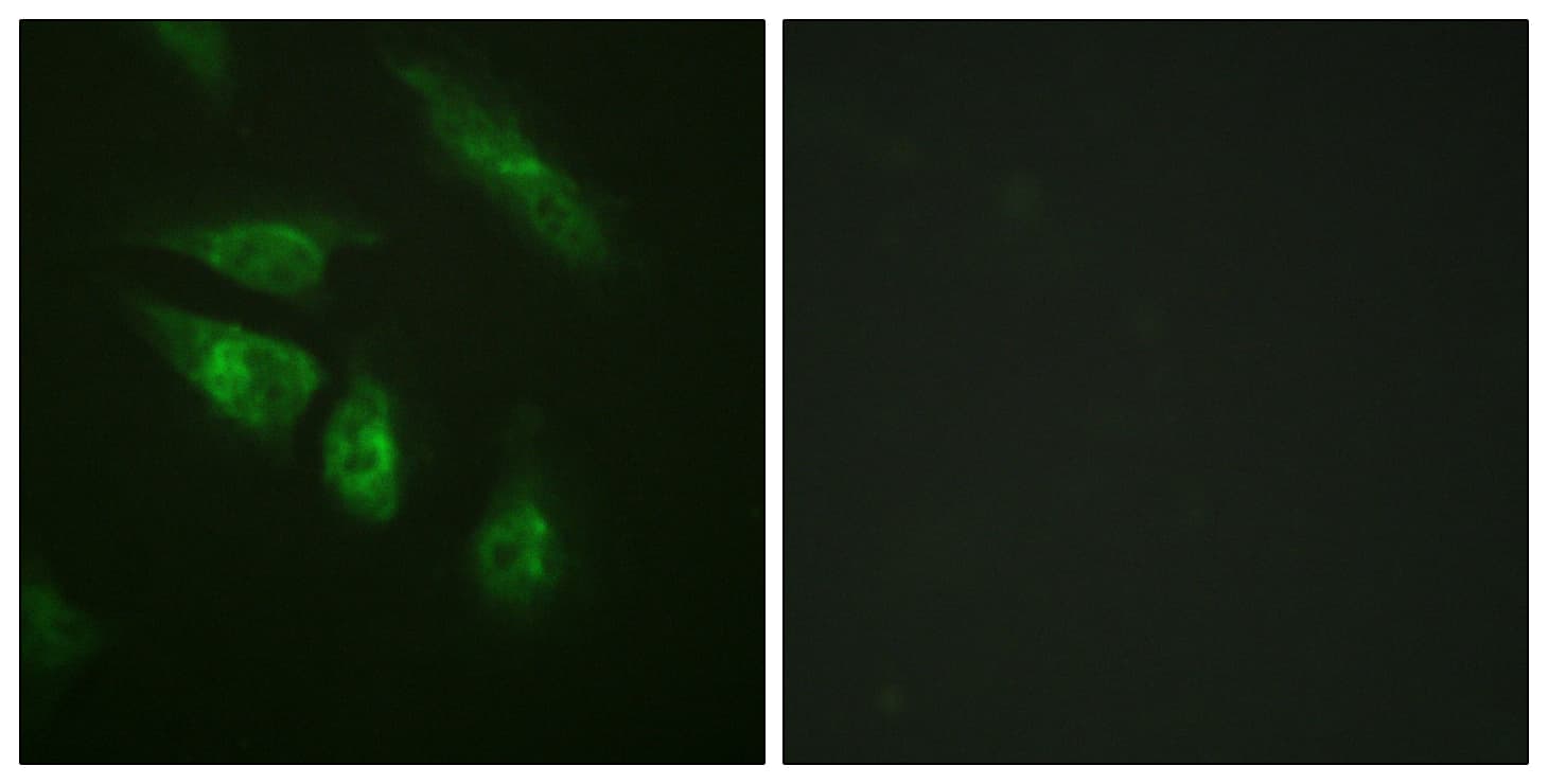 NFATC4 / NFAT3 Antibody (aa642-691)